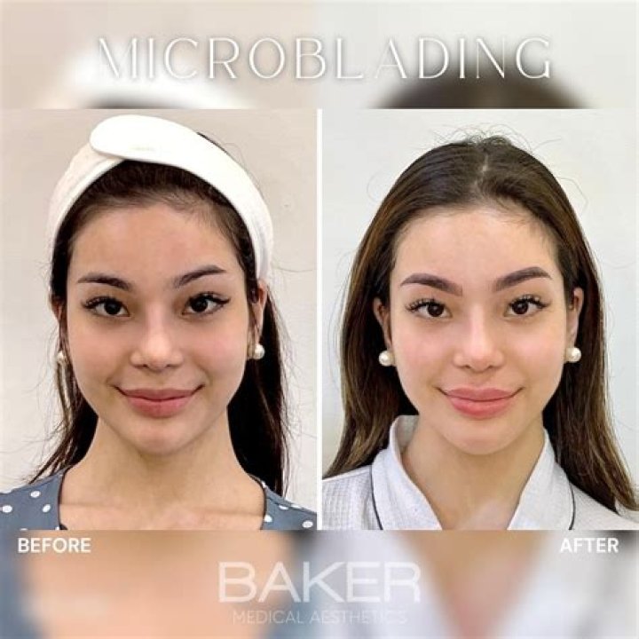 Before And After Plastic Surgery On Kitty Duterte: A New Look And Transformation
